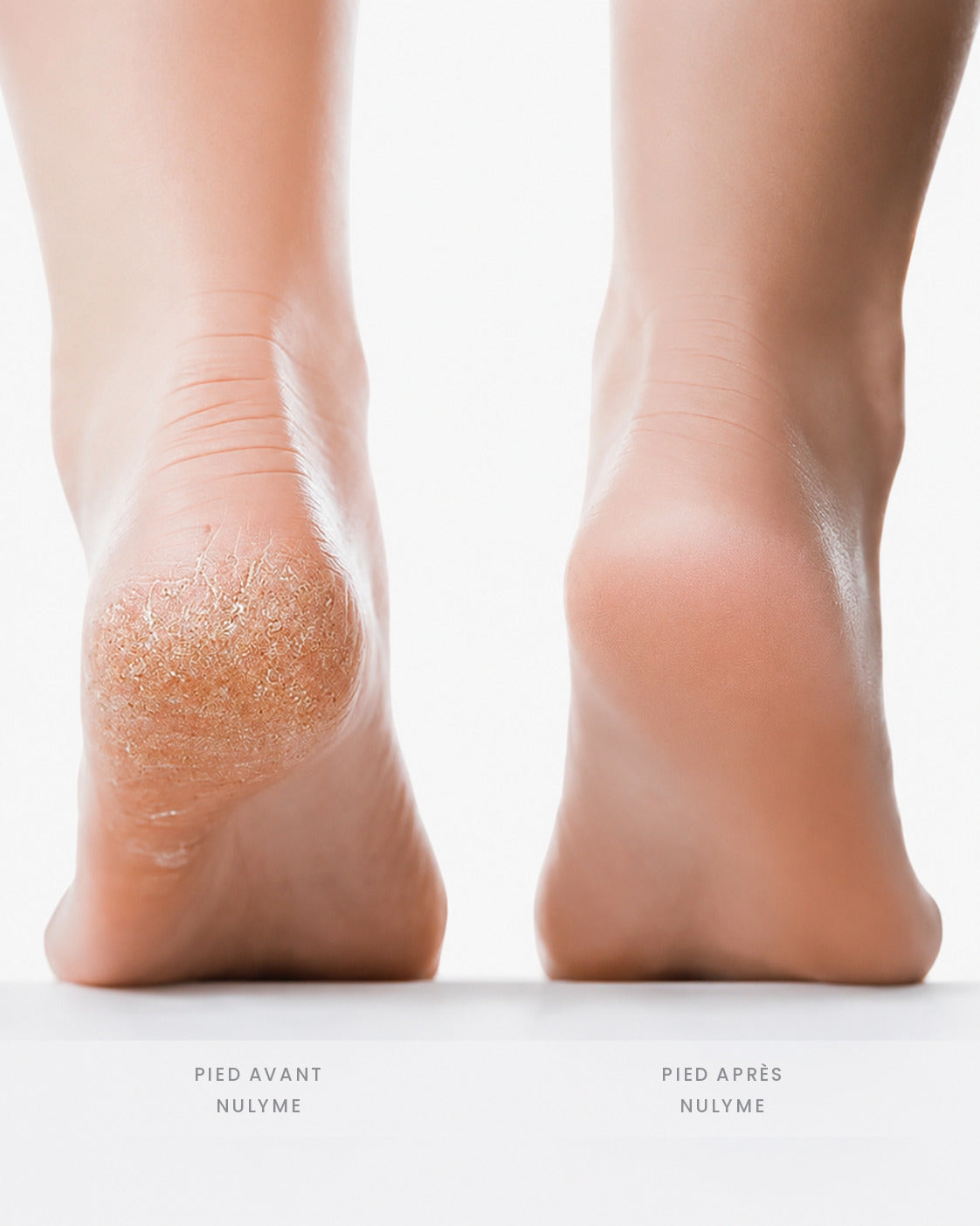 Ponceuse électrique pour pieds Nulyme